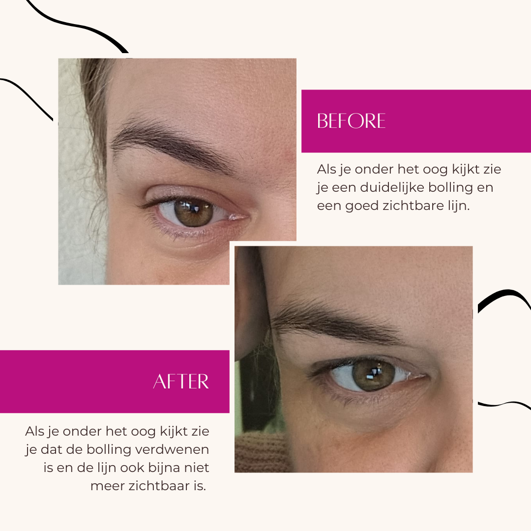 review oogcreme